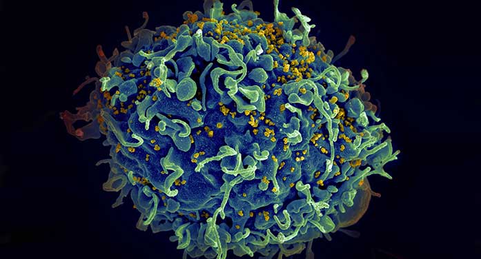 Study reveals why HIV remains in human tissue even after therapy